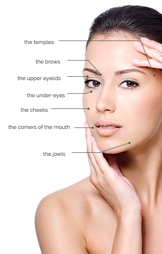 Areas to eliminate Lines and Wrinkles