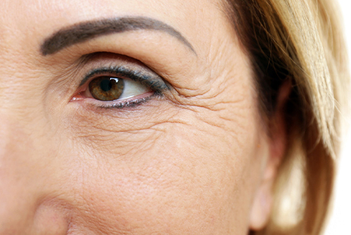 Fine Lines and Wrinkles: An Overview